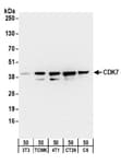 Detection of mouse and rat CDK7 by western blot.