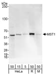 Detection of human and mouse MST1by western blot.