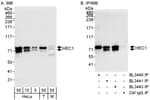 Detection of human and mouse HEC1 by western blot (h&amp;m) and immunoprecipitation (h).