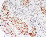 Detection of human BAP1 by immunohistochemistry.