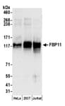 Detection of human FBP11 by western blot.