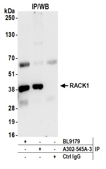 Detection of human RACK1 by western blot of immunoprecipitates.