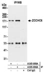 Detection of human ZCCHC6 by western blot of immunoprecipitates.