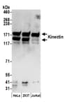 Detection of human Kinectin by western blot.