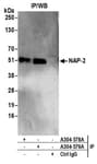 Detection of human NAP-2 by western blot of immunoprecipitates.