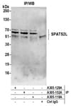 Detection of human SPATS2L by western blot of immunoprecipitates.