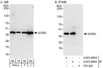 Detection of human SORD by western blot and immunoprecipitation.