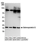 Detection of human Selenoprotein S by western blot.