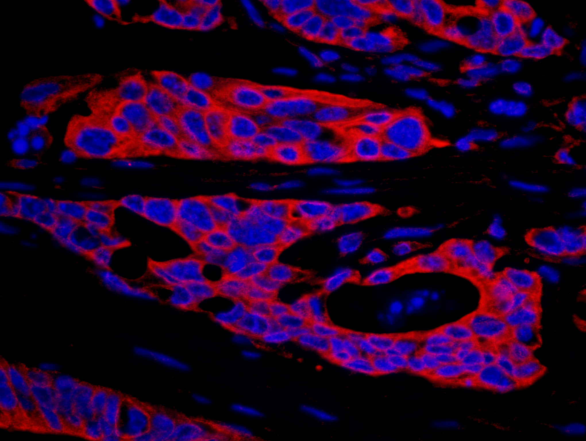 Rabbit anti-SPAK IHC Antibody