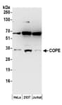 Detection of human COPE by western blot.