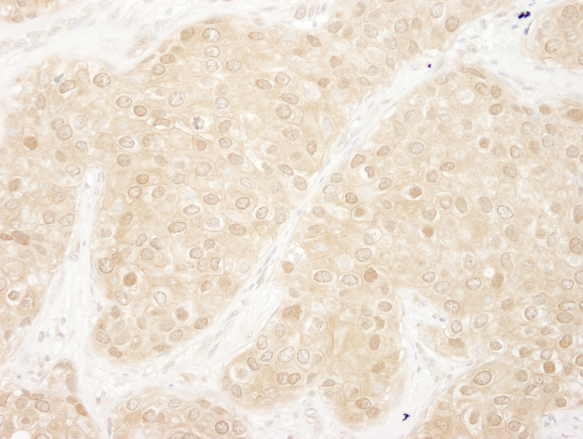 Rabbit anti-ERK1 IHC Antibody