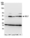 Detection of human and mouse SCLY by western blot.