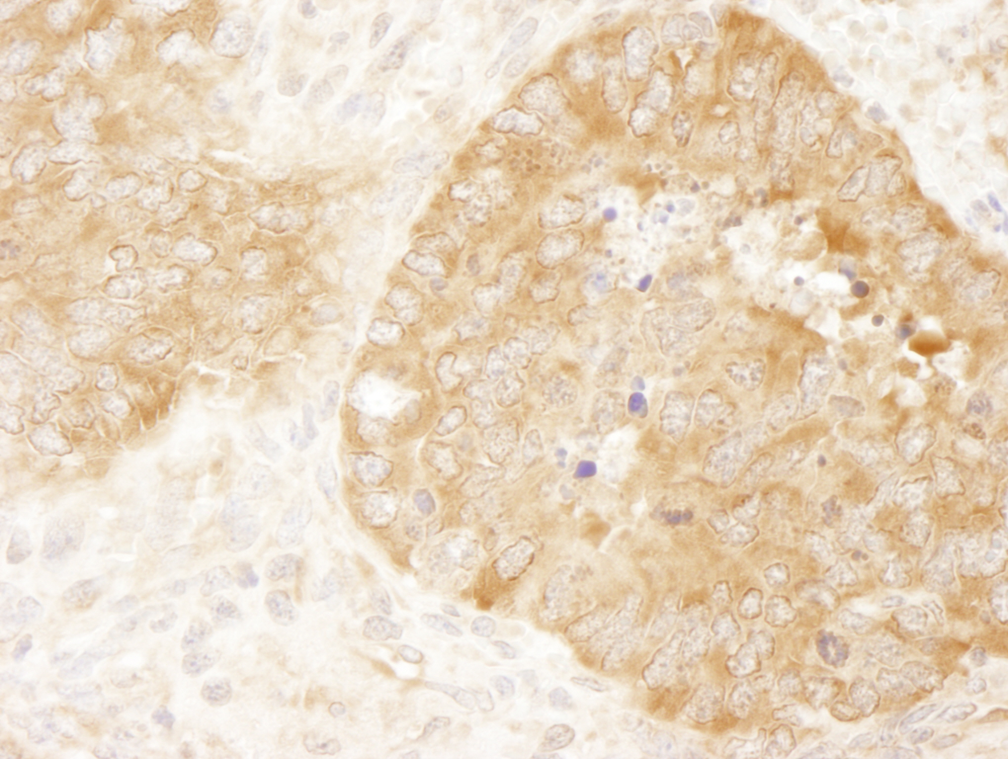Rabbit anti-eIF2alpha/EIF2S1 IHC Antibody