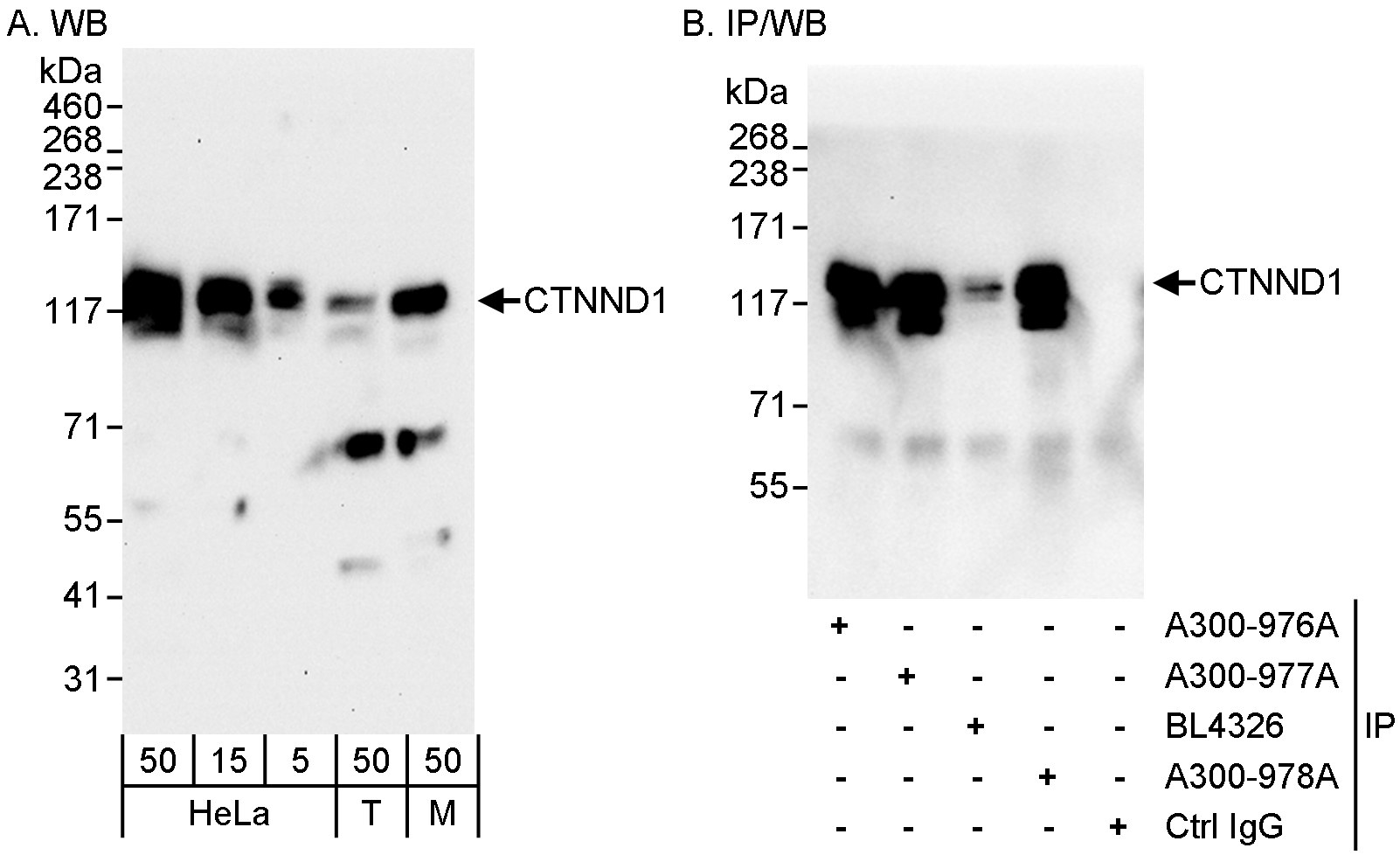 Detection of human and mouse CTNND1 by western blot (h&amp;m) and immunoprecipitation (h).