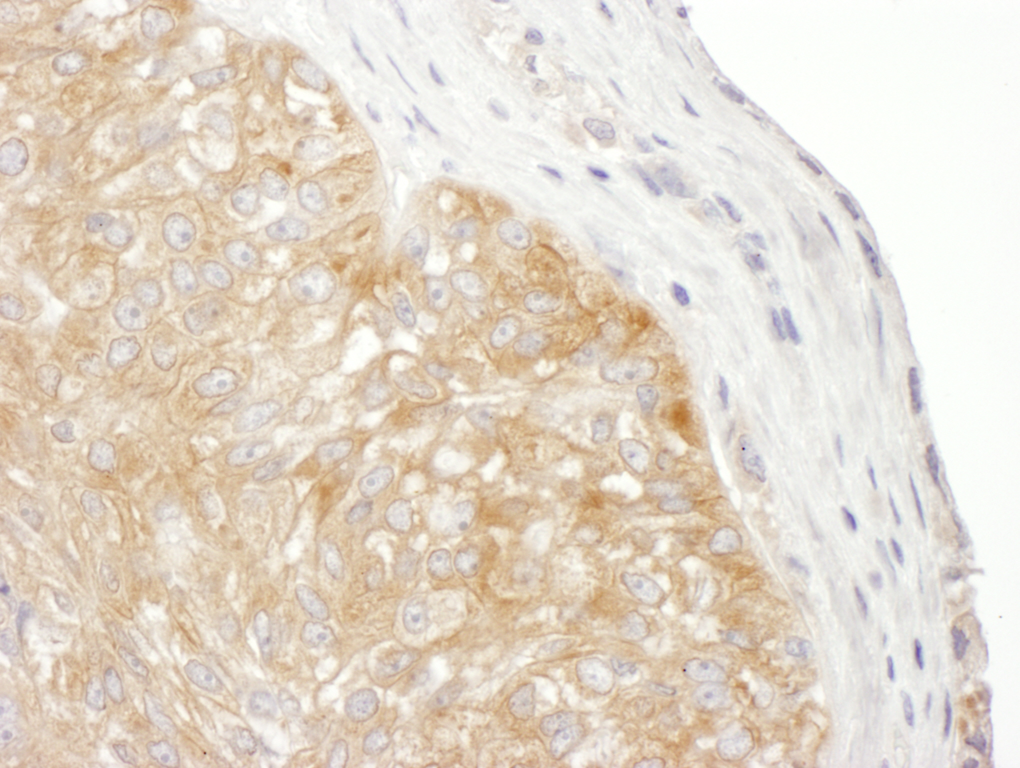 Detection of human RPS9 by immunohistochemistry.