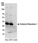Detection of human Carbonyl Reductase 1/CBR1 by western blot.