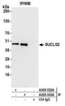 Detection of human SUCLG2 by western blot of immunoprecipitates.