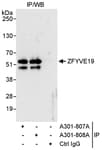 Detection of human ZFYVE19 by western blot of immunoprecipitates.