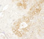Detection of mouse beta Catenin by immunohistochemistry.
