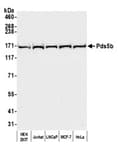 Detection of human Pds5b by western blot.