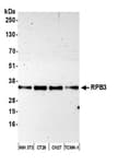 Detection of mouse RPB3 by western blot.