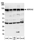 Detection of human SERCA2 by western blot.