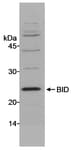 Detection of mouse BID by western blot.