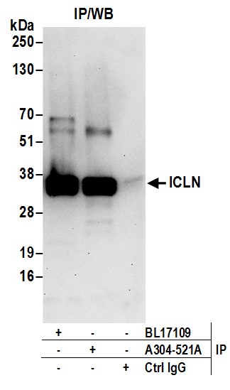 Detection of human ICLN by western blot of immunoprecipitates.
