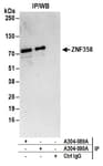 Detection of human ZNF358 by western blot of immunoprecipitates.