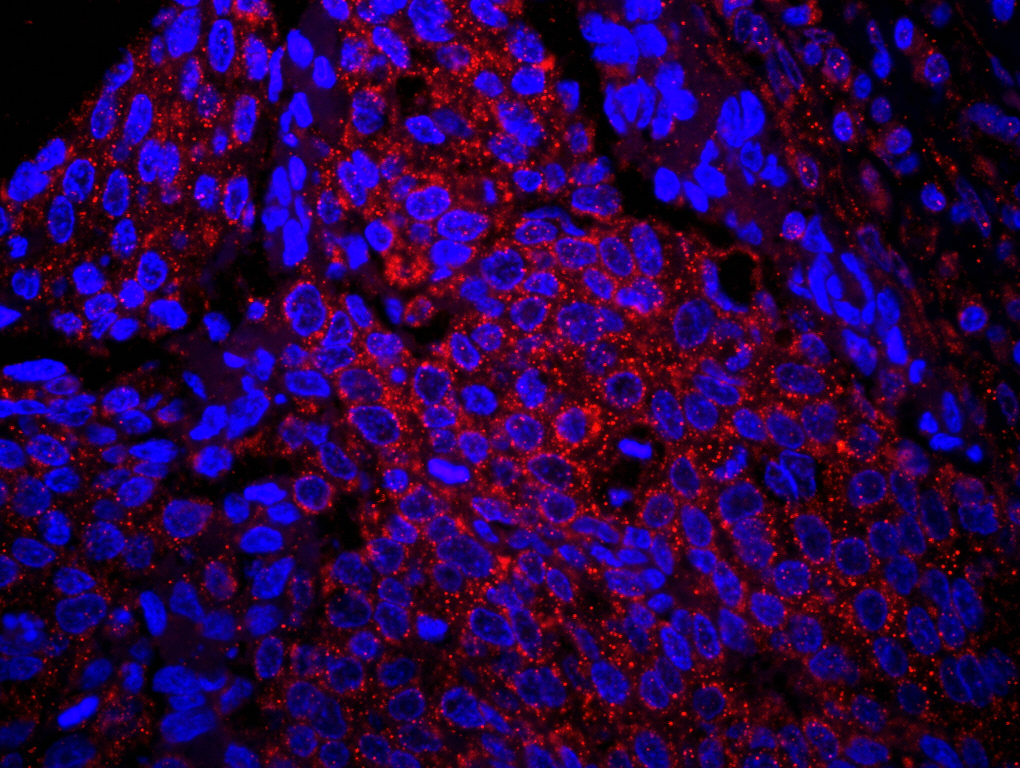 Detection of human IRS1 by immunohistochemistry.