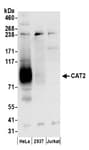 Detection of human CAT2 by western blot.