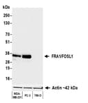 Detection of human FRA1/FOSL1 by western blot.