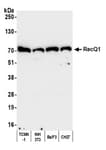 Detection of mouse RecQ1 by western blot.