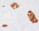 Detection of human Insulin by immunohistochemistry.