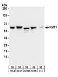 Detection of human and mouse NMT1 by western blot.