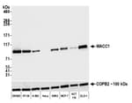 Detection of human MACC1 by western blot.