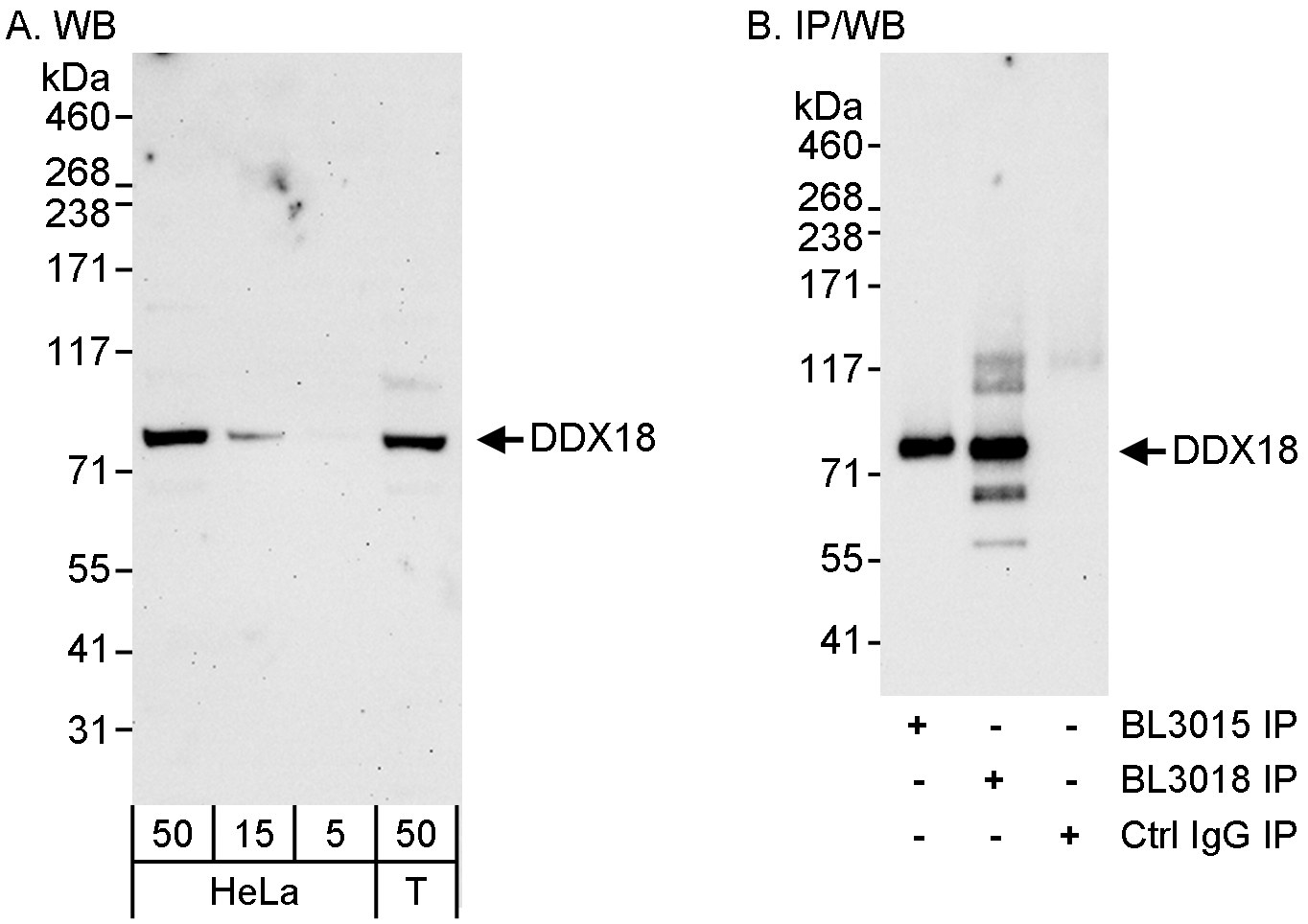 Detection of human DDX18 by western blot and immunoprecipitation.