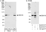 Detection of human DDX18 by western blot and immunoprecipitation.