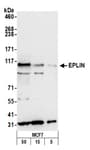 Detection of human EPLIN by western blot.