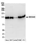 Detection of human and mouse SEC24D by western blot.