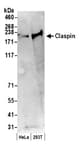 Detection of human Claspin by western blot.