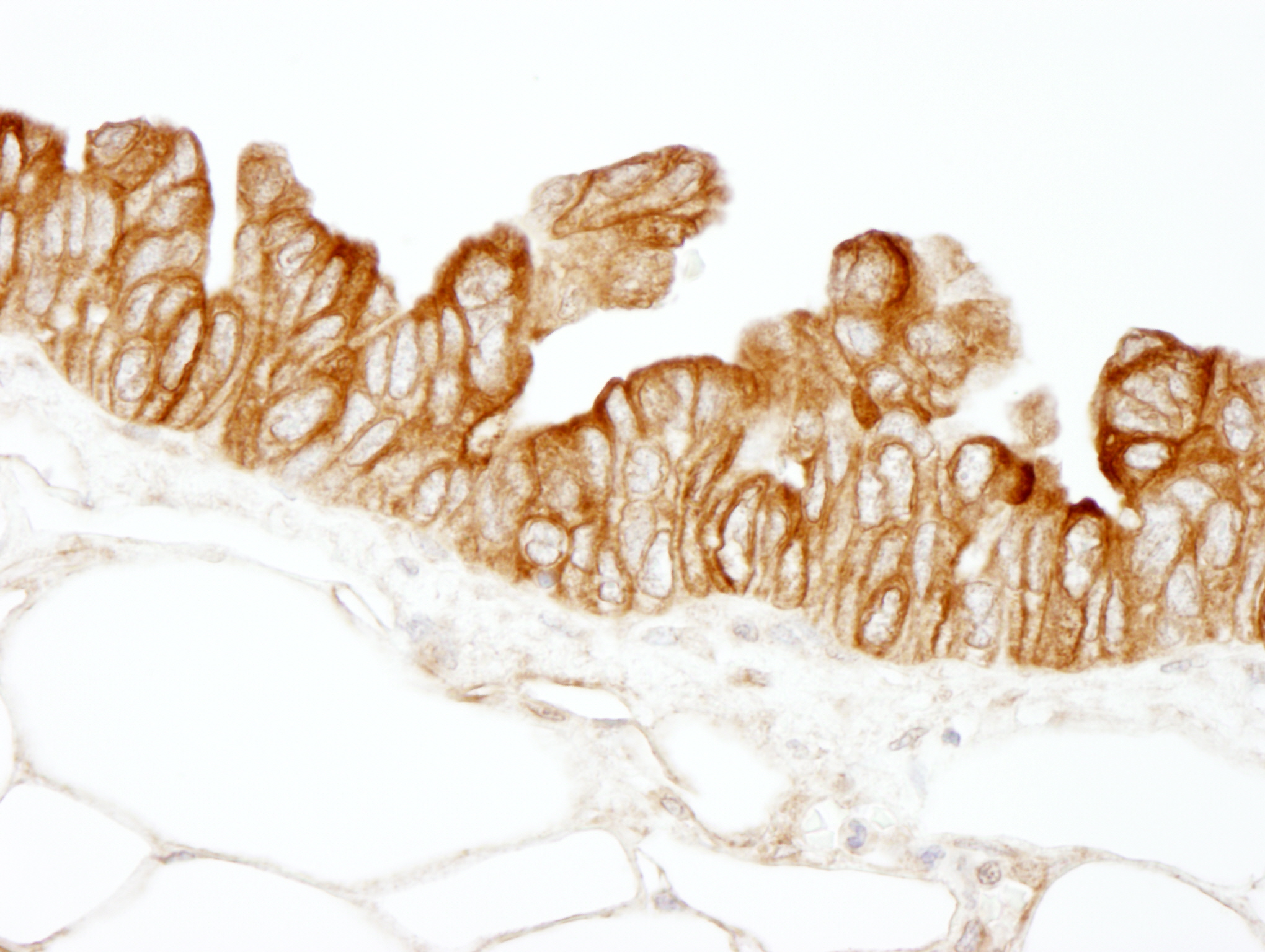 Rabbit anti-HPIP IHC Antibody