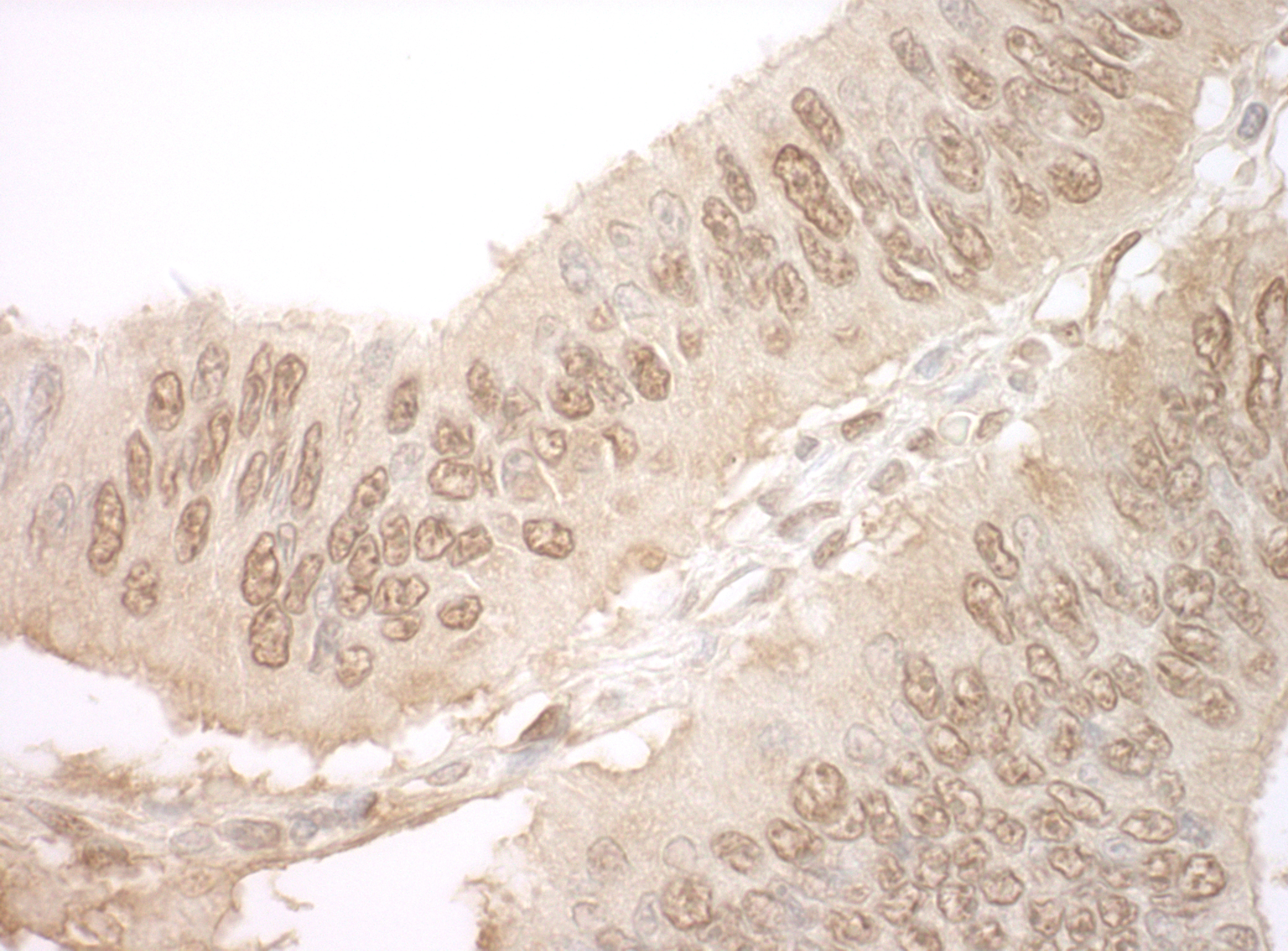 Rabbit anti-JMY IHC Antibody