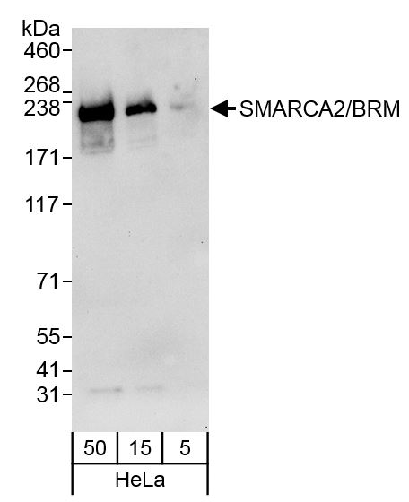 Detection of human SMARCA2/BRM by western blot.