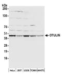 Detection of human and mouse OTULIN by western blot.