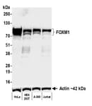 Detection of human FOXM1 by western blot.