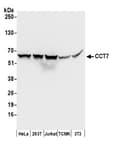 Detection of human and mouse CCT7 by western blot.