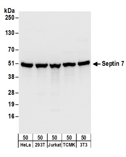 Detection of human and mouse Septin 7 by western blot.