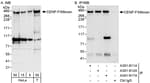 Detection of human CENP-F/Mitosin by western blot and immunoprecipitation.