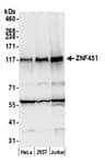 Detection of human ZNF451 by western blot.